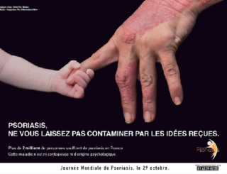 Psoriasis : journée mondiale le 29 octobre