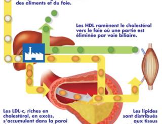 Les dyslipidémies