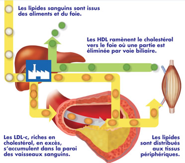 Les dyslipidémies