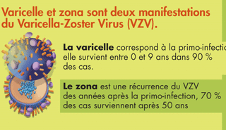 La varicelle et le zona