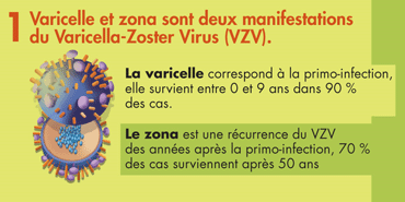 La varicelle et le zona