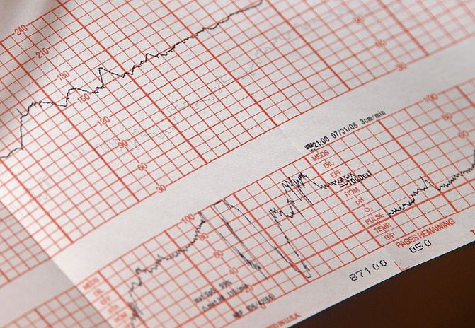 Rémunération : un bilan trimestriel bien pâle et une ROSP génériques versée en mai