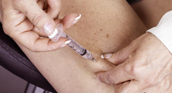 Injection de ceftriaxone par voie SC : finalement possible (sous conditions)