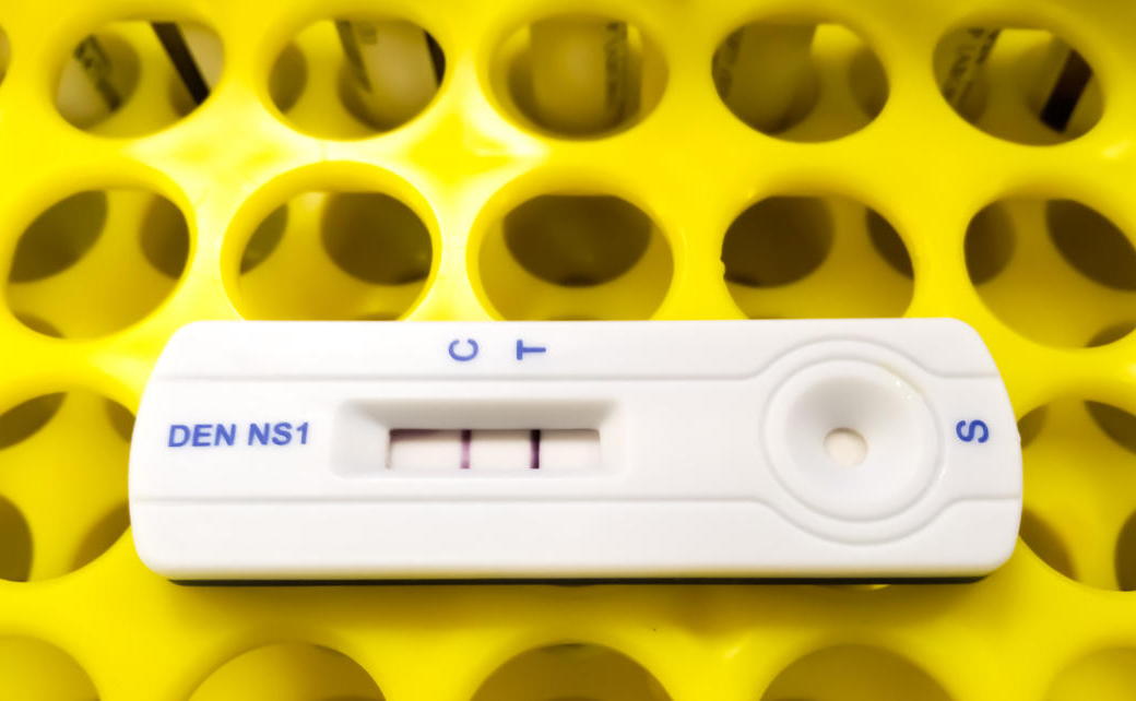 Tests antigéniques Covid-19 : le nouveau dispositif de remboursement fait planer le risque d’indus