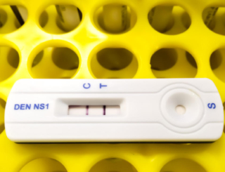 Tests antigéniques Covid-19 : le nouveau dispositif de remboursement fait planer le risque d’indus