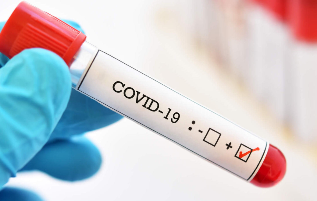 Covid-19 : les tests remboursés coûtent un bras à l’Assurance maladie