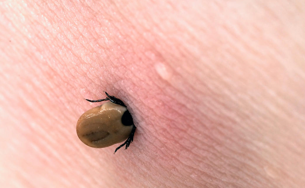 Maladie de Lyme : un guide pour savoir qui consulter