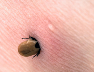 Maladie de Lyme : un guide pour savoir qui consulter