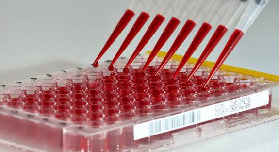 Tests antigéniques Covid-19 positifs : à confirmer par un PCR !