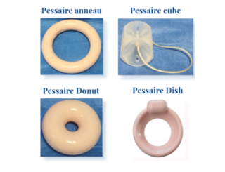 Pessaires : inscription au remboursement