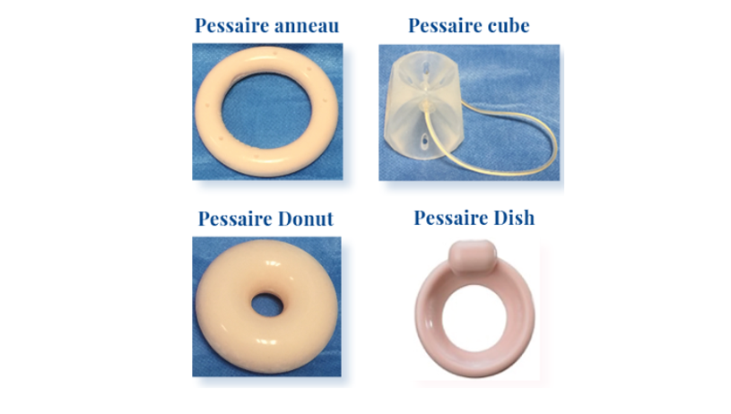Pessaires : inscription au remboursement