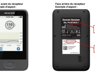 Récepteur Dexcom G6 : des problèmes d’alarme signalés