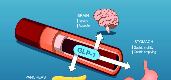 Nouvelles règles de prescription des analogues du GLP-1 : ça change quoi ?