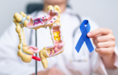 Cancer colorectal : identifier les risques pour mieux prévenir